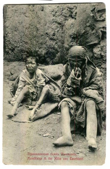 1914 Ташкент Окрестности Прокаженные